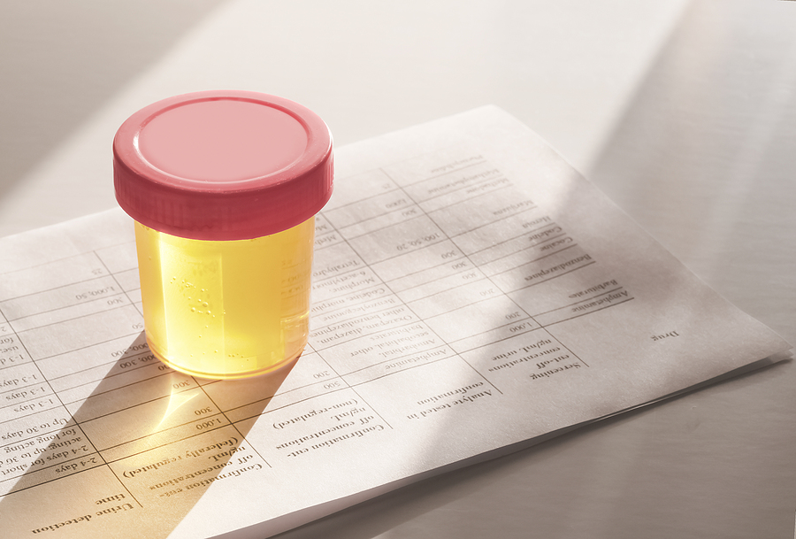 Indiana Probation Drug Testing